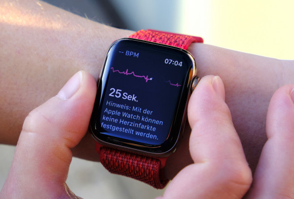 Die Apple Watch kann jetzt auch in der Schweiz EKG 